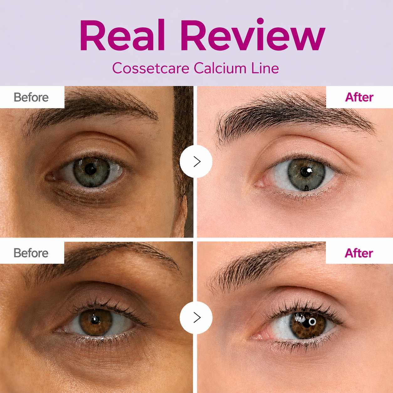 🔥LAST DAY 50% OFF!!Cossetcare Korean Calcium Dark Spot Eye Cream
